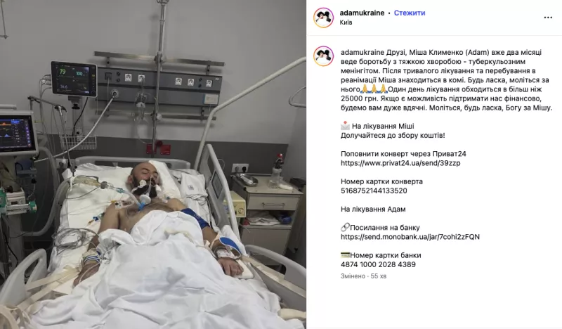 Адам у комі: українські зірки шоковані критичним станом співака Михайла Клименка